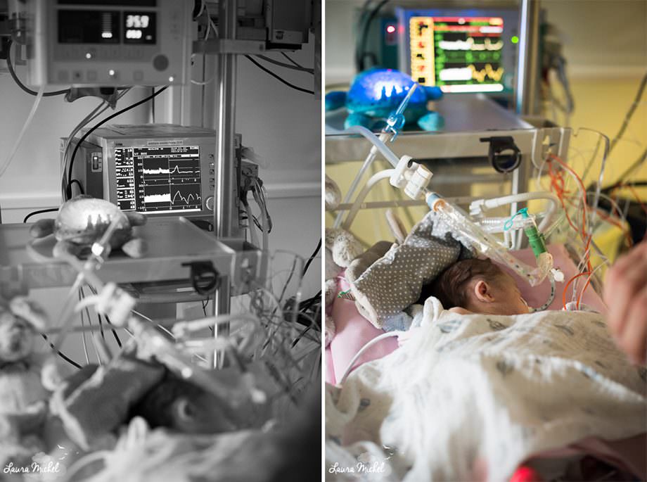 reportage-photographe-reanimation-pediatrique-bebe-pathologie-cardiaque-16-17