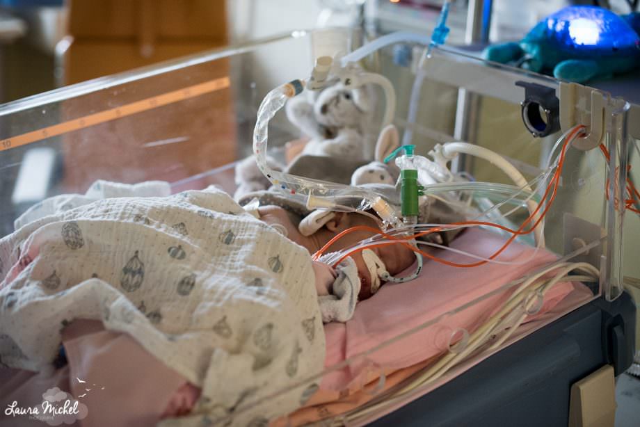 reportage-photographe-reanimation-pediatrique-bebe-pathologie-cardiaque-22