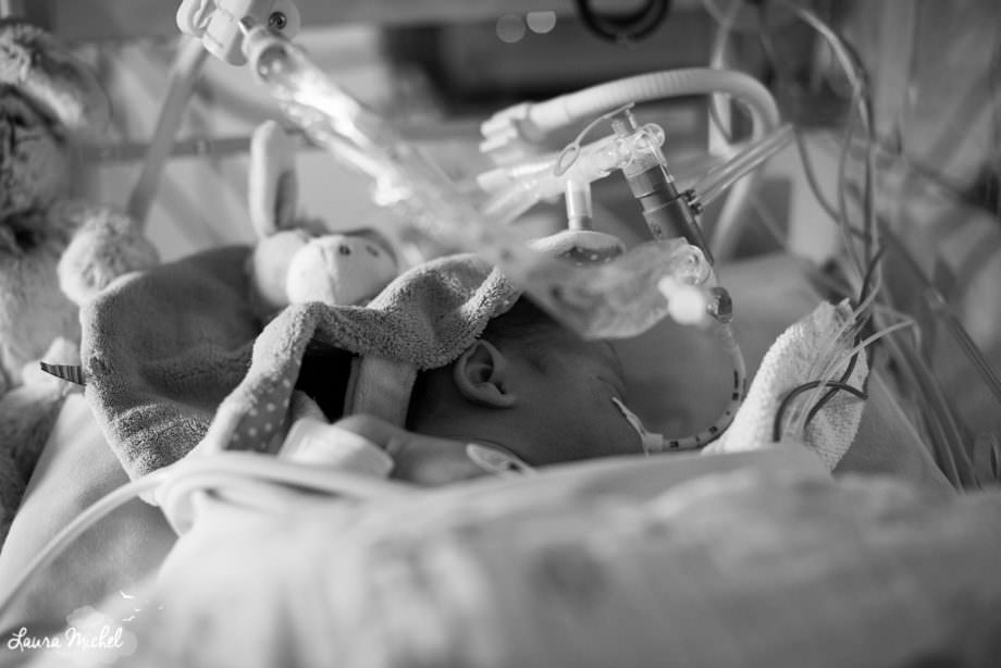 reportage-photo-reanimation-pediatrique-bebe-pathologie-cardiaque-3