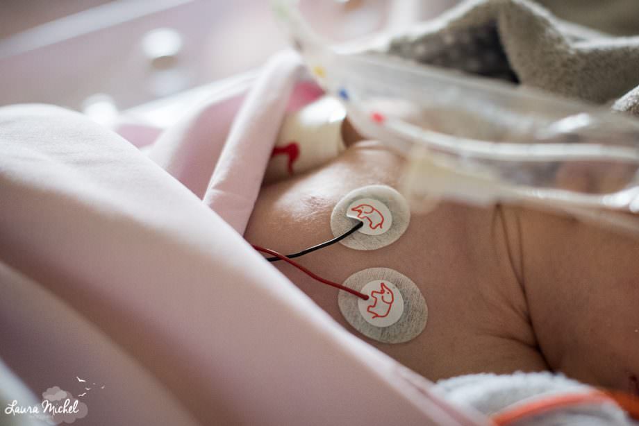 reportage-photo-reanimation-pediatrique-bebe-pathologie-cardiaque-4