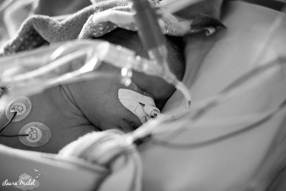 reportage-photo-reanimation-pediatrique-bebe-pathologie-cardiaque-5