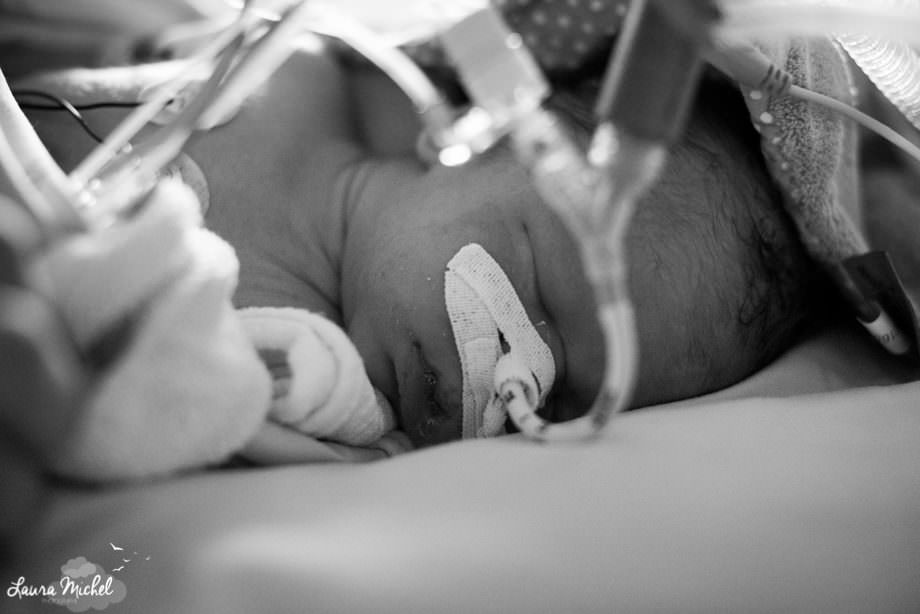 reportage-photographe-reanimation-pediatrique-bebe-pathologie-cardiaque-7